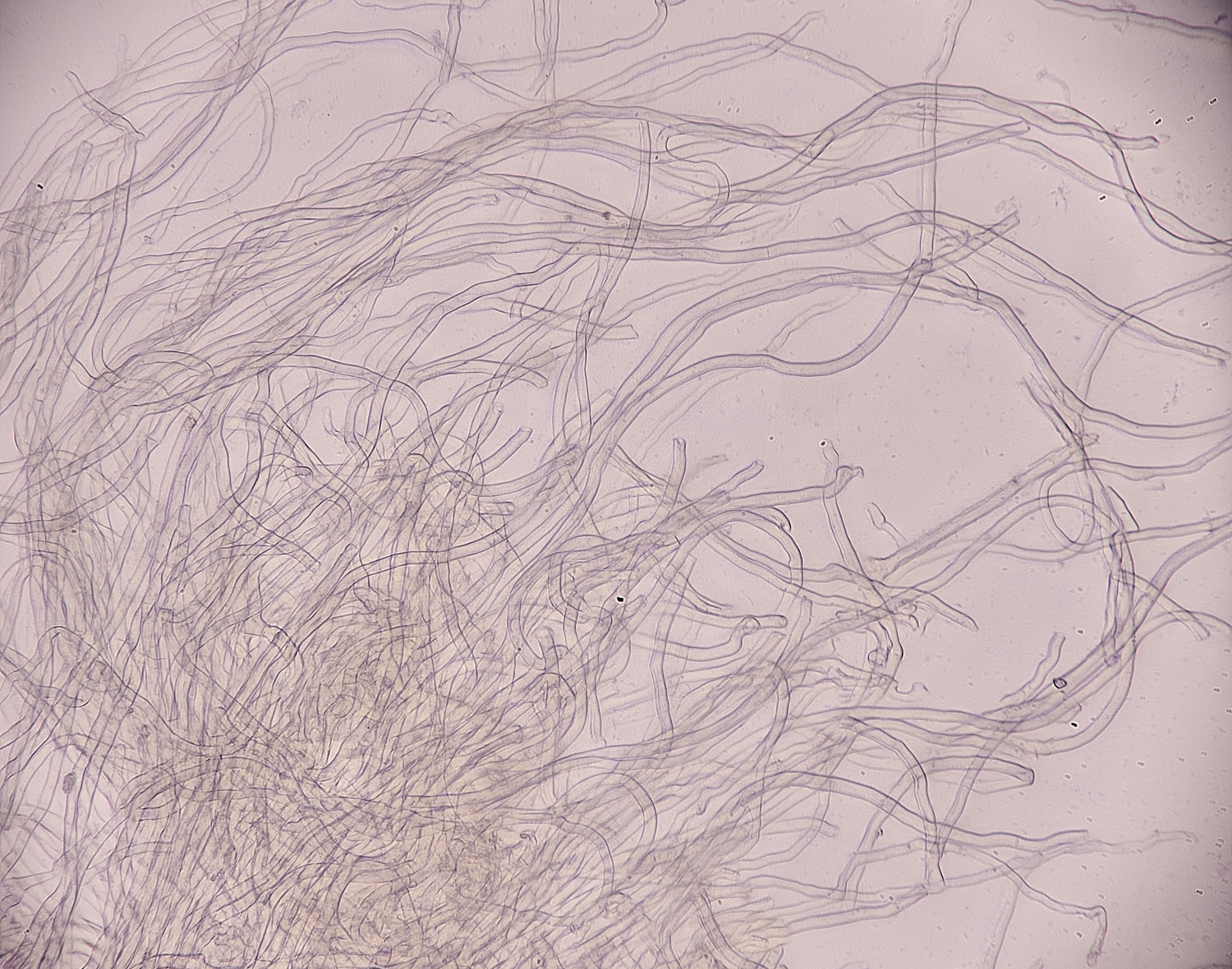 DillingtonScocinnea110125-1 1