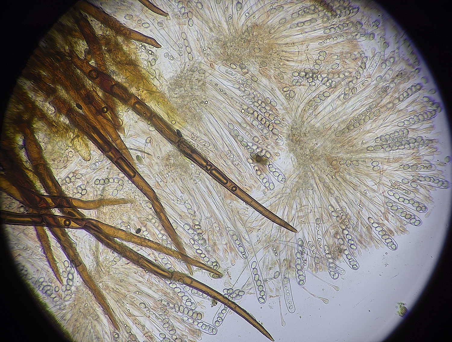 EarshamEyelash260125-3