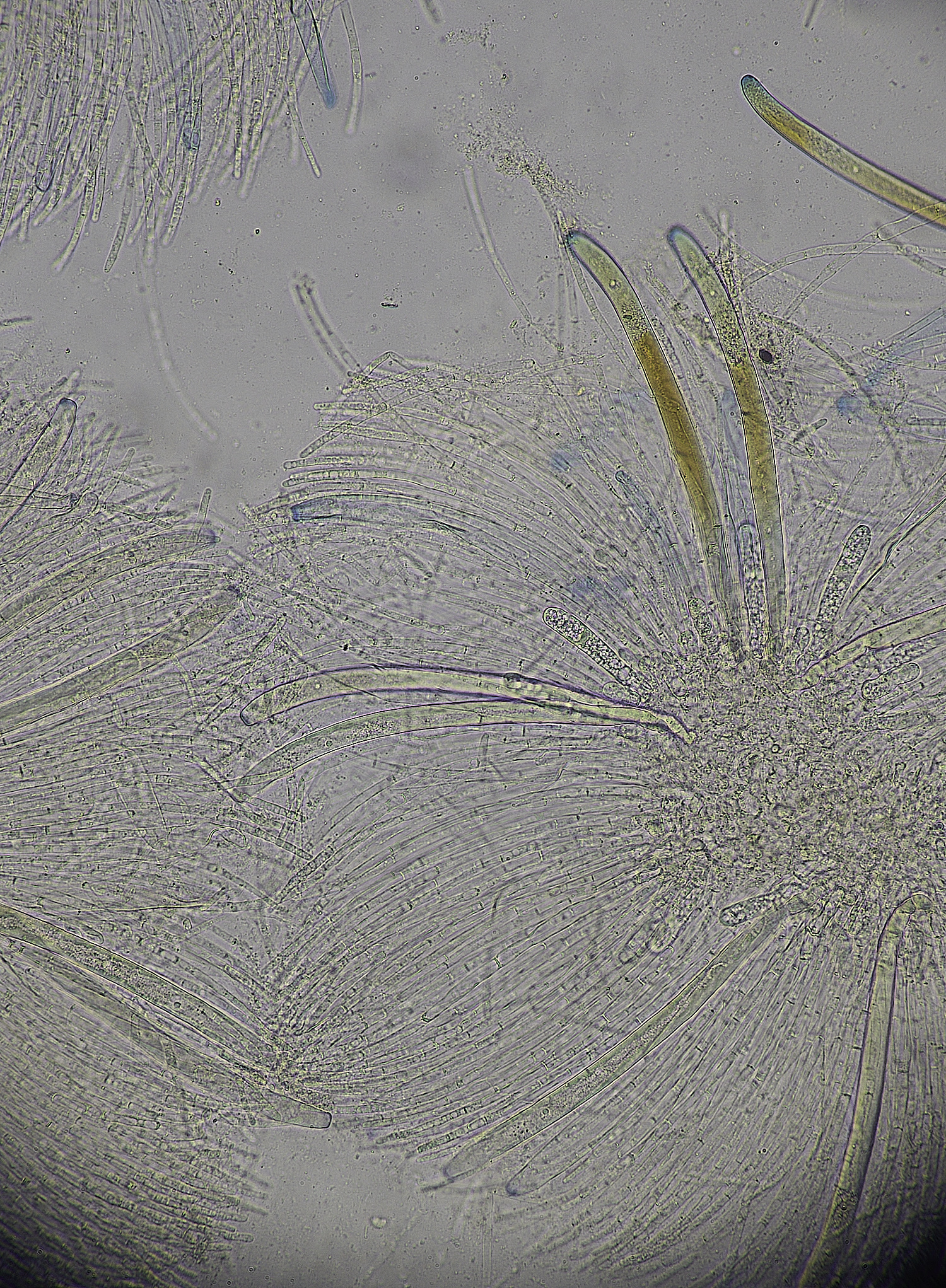 WheatfenPeziza300125-2 1