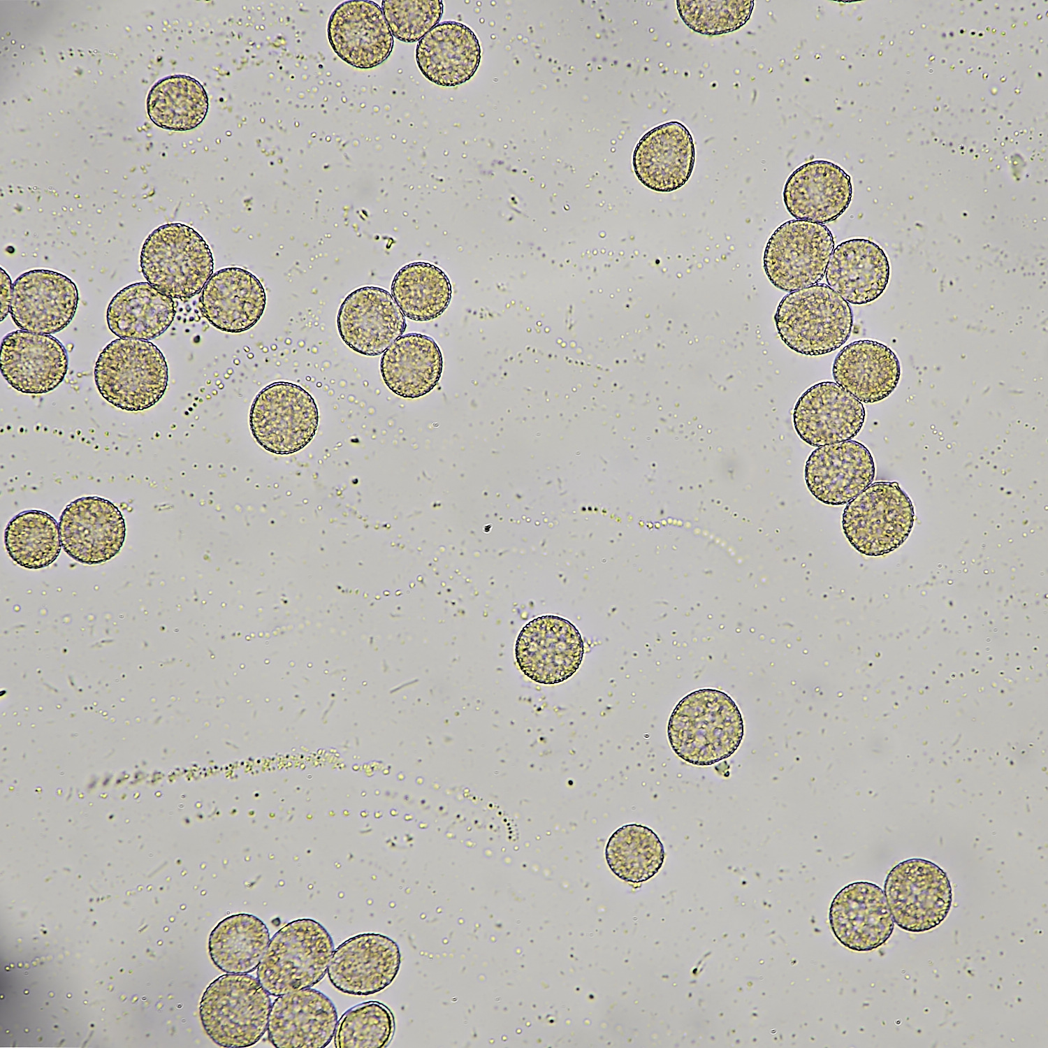 AshwellthorpeWoodDMRust020525-1