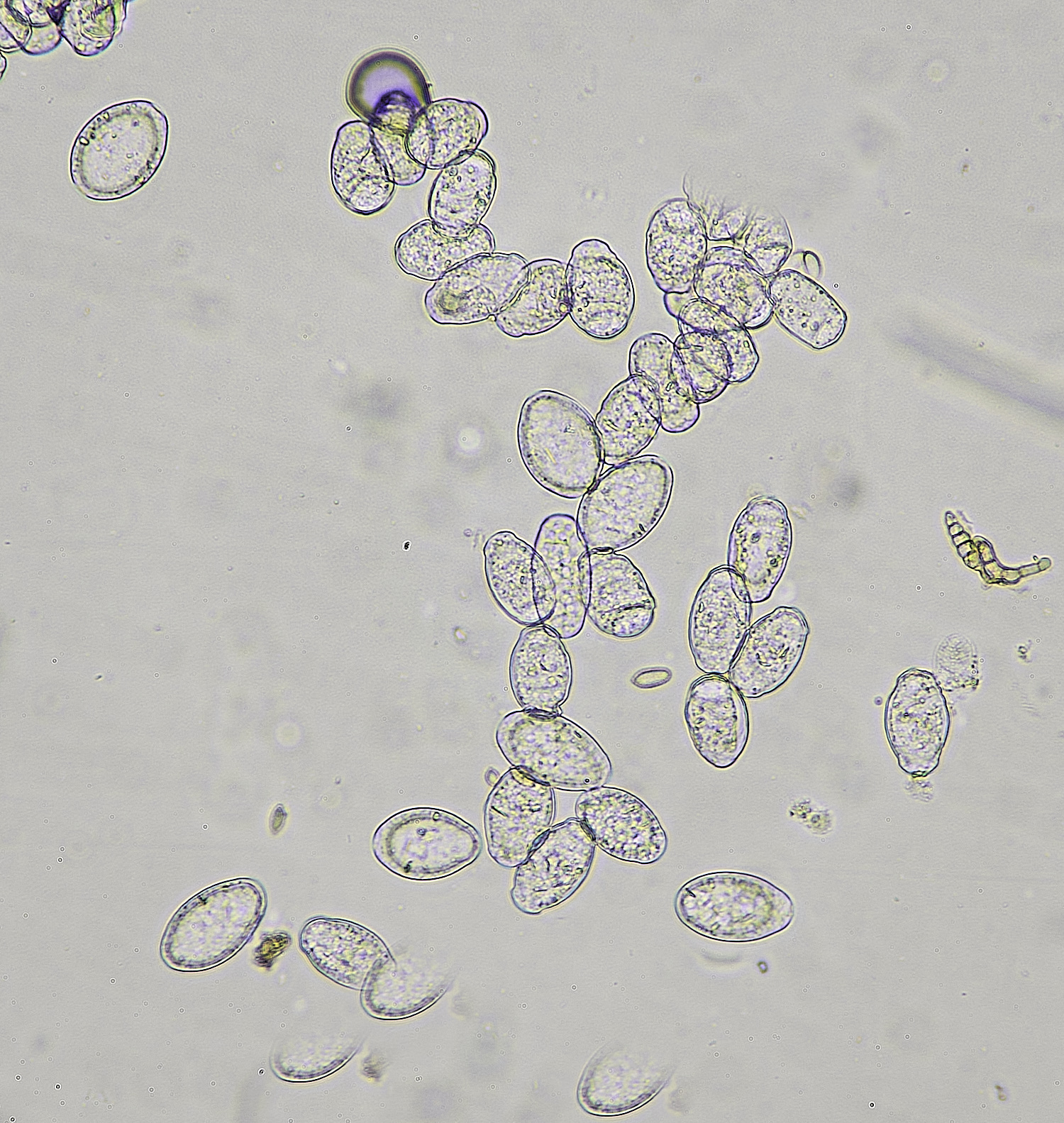 HanworthFieldScabiousDOwnyMildew220625-2