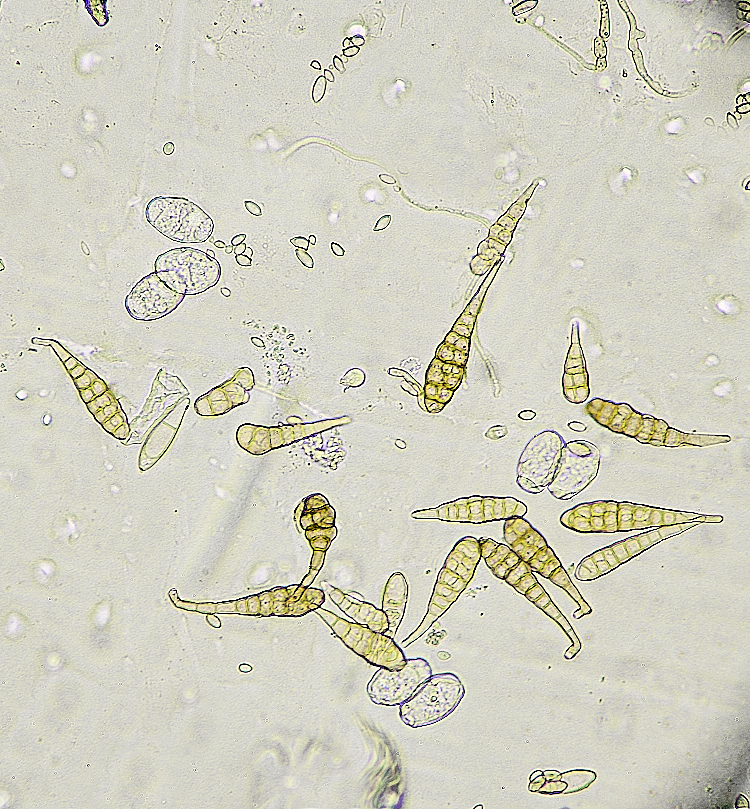 HanworthFieldScabiousDOwnyMildew220625-3
