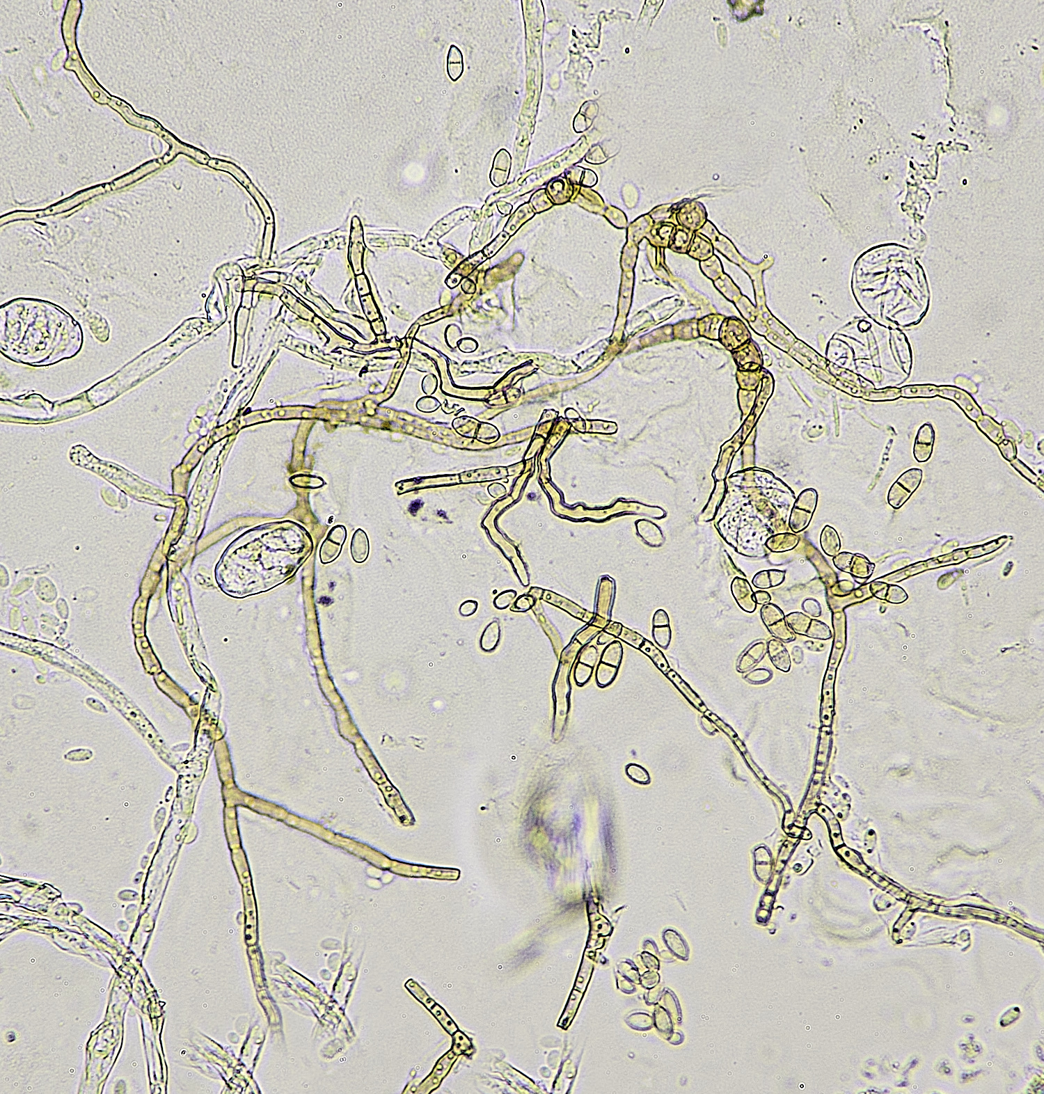 HanworthFieldScabiousDOwnyMildew220625-4