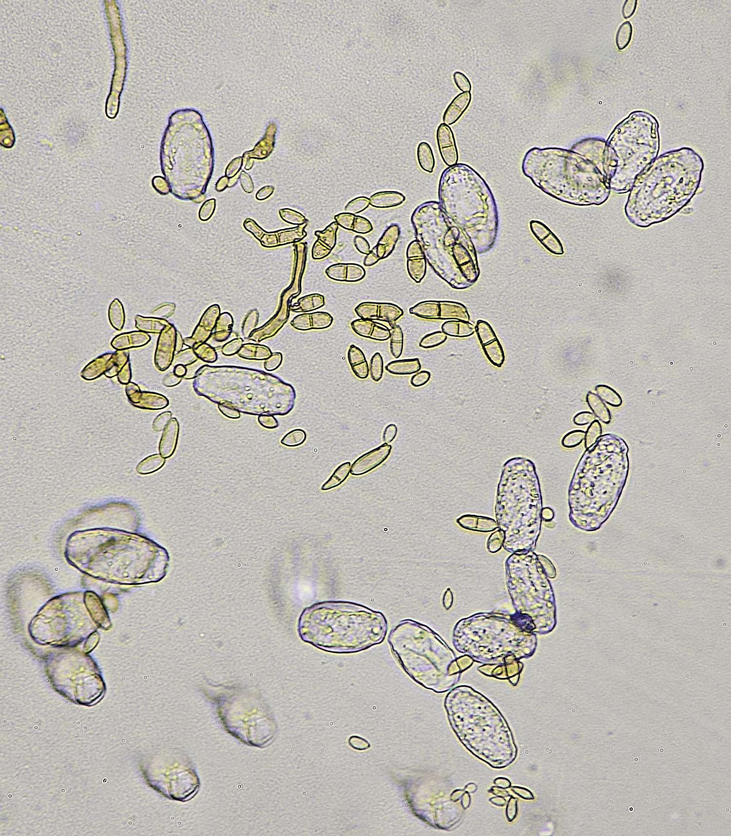 HanworthFieldScabiousDOwnyMildew220625-5