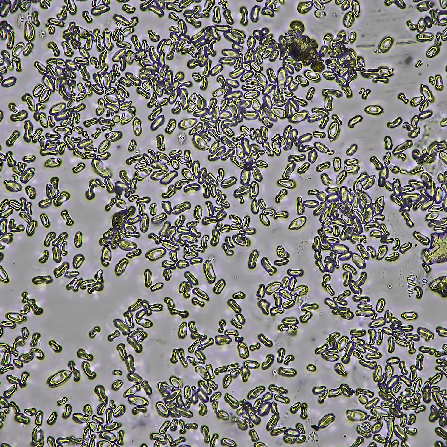 LittlePlumsteadDownyMildewPrimrose270425-2