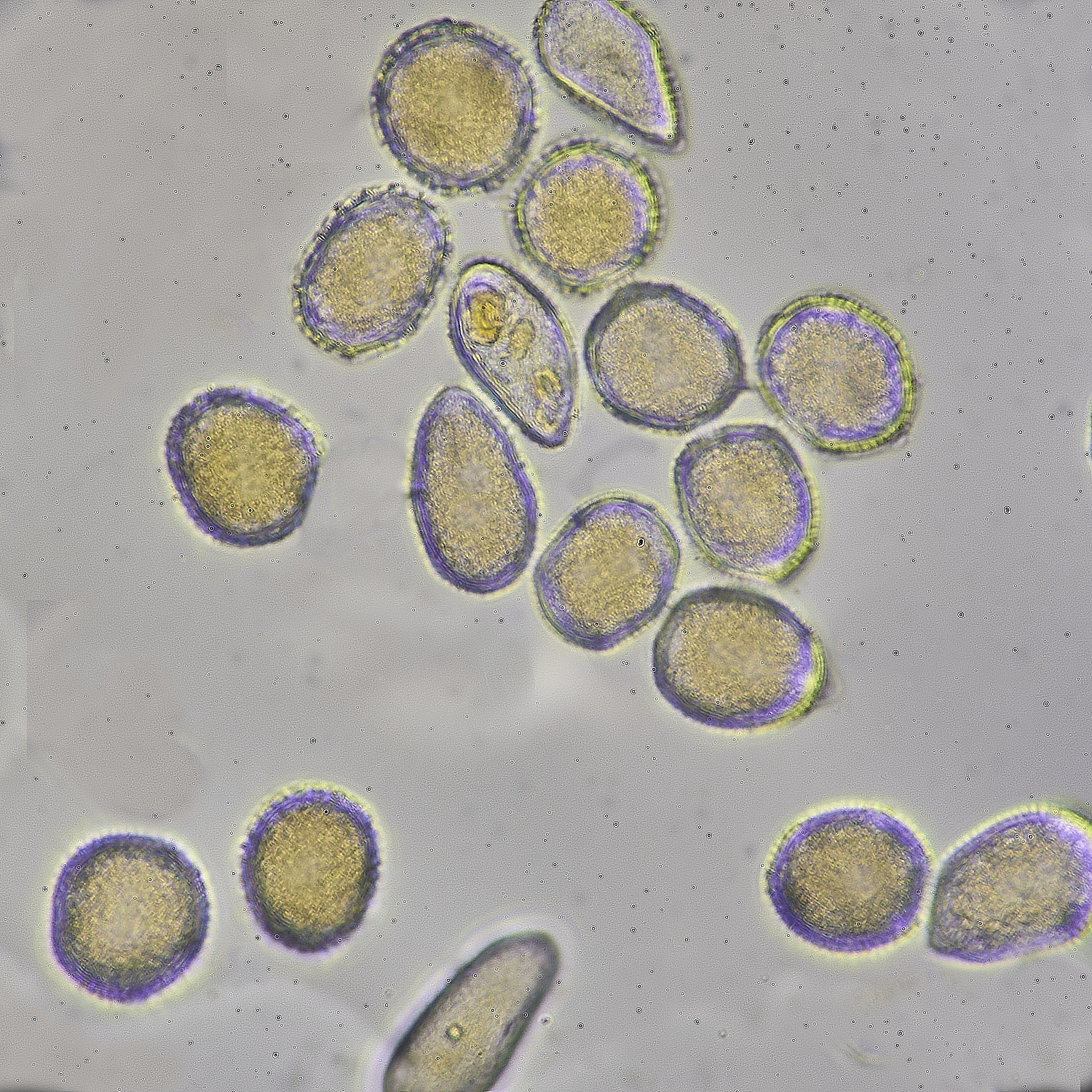 WalseyHillsAlexanders070425-7